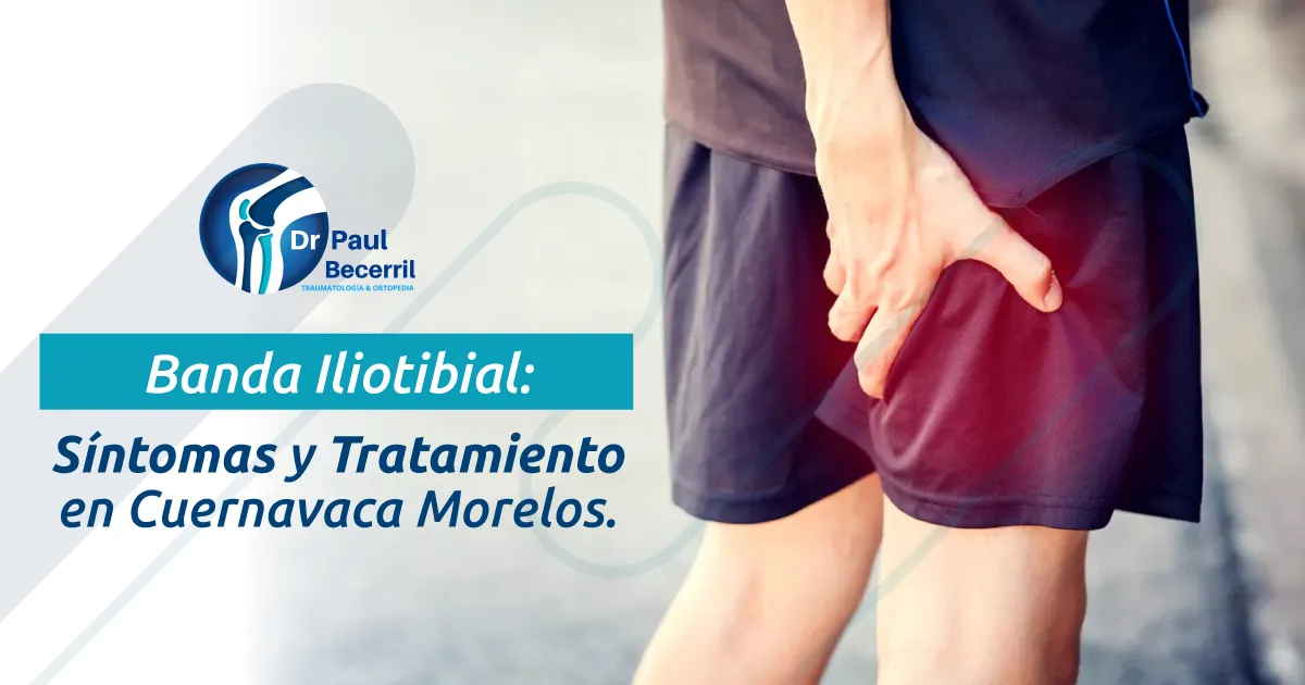 Corredor con dolor en la parte externa de la rodilla por síndrome de la banda iliotibial