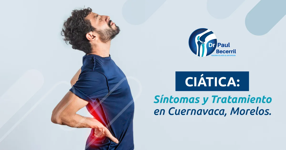 Paciente con dolor de ciática irradiado a la pierna