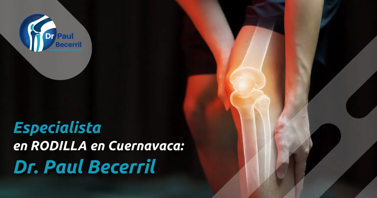 Especialista revisando la rodilla de un paciente en Cuernavaca