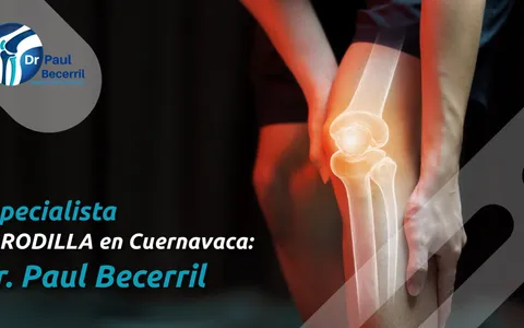 Especialista revisando la rodilla de un paciente en Cuernavaca