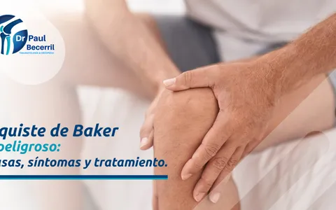 Rodilla con quiste de Baker